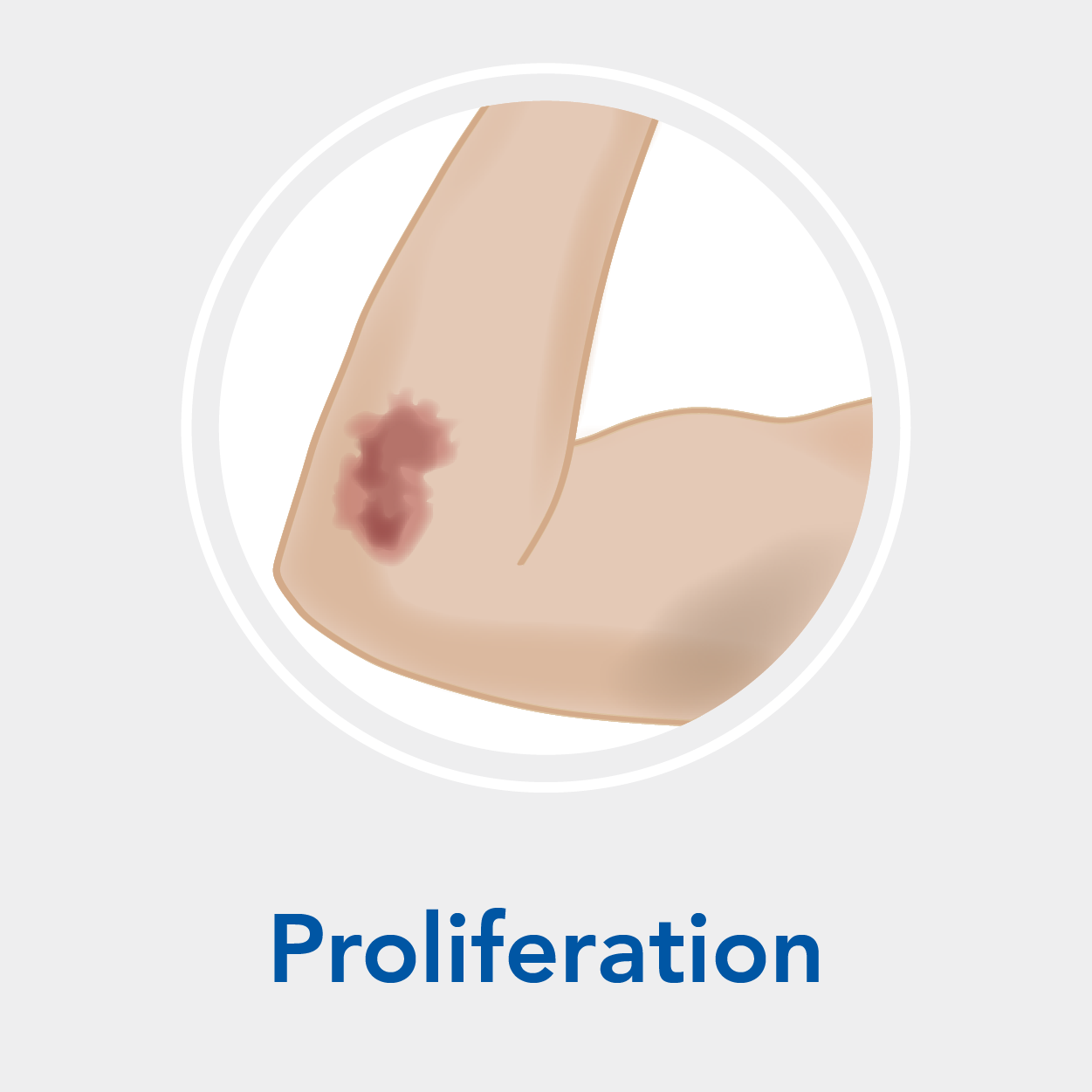 Stage 3: Proliferation