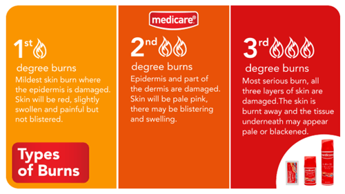 types of burns