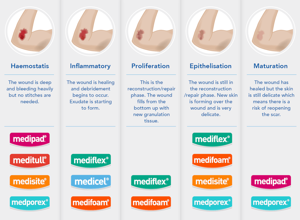 The Five Stages of Wound Healing